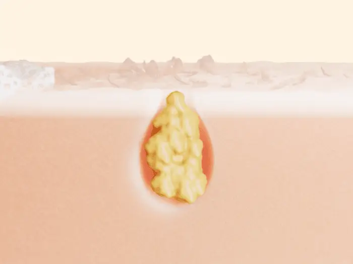 [여드름성피부/피지제거] 에이프릴스킨 캐로틴 아크네 폼클렌저 120ml 상세페이지 14